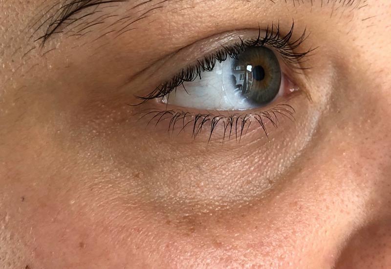 permanent-cc-eye-concealer-saarland-make-up CC Eye Behandlung