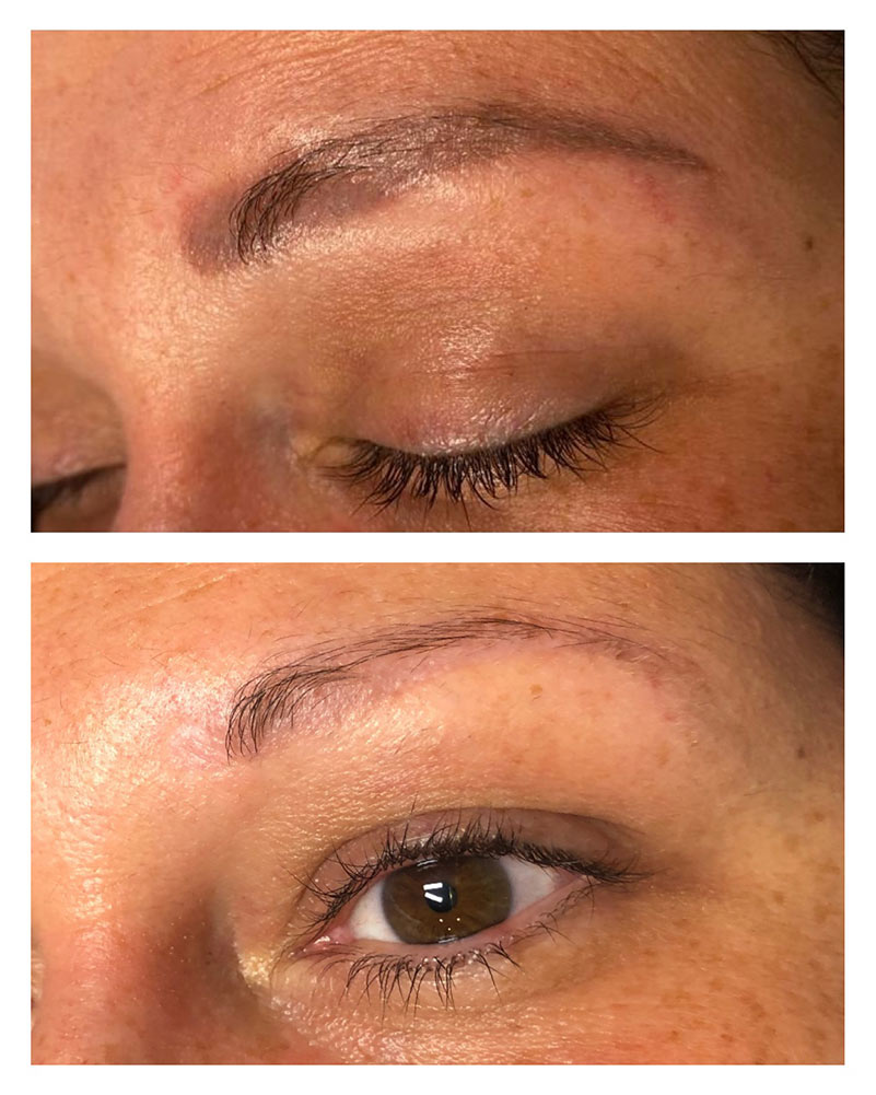 permanent-makeup-entfernen-saarland Permanent Make up entfernen